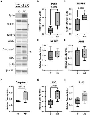 Extracellular vesicles mediate inflammasome signaling in the brain and heart of Alzheimer’s disease mice